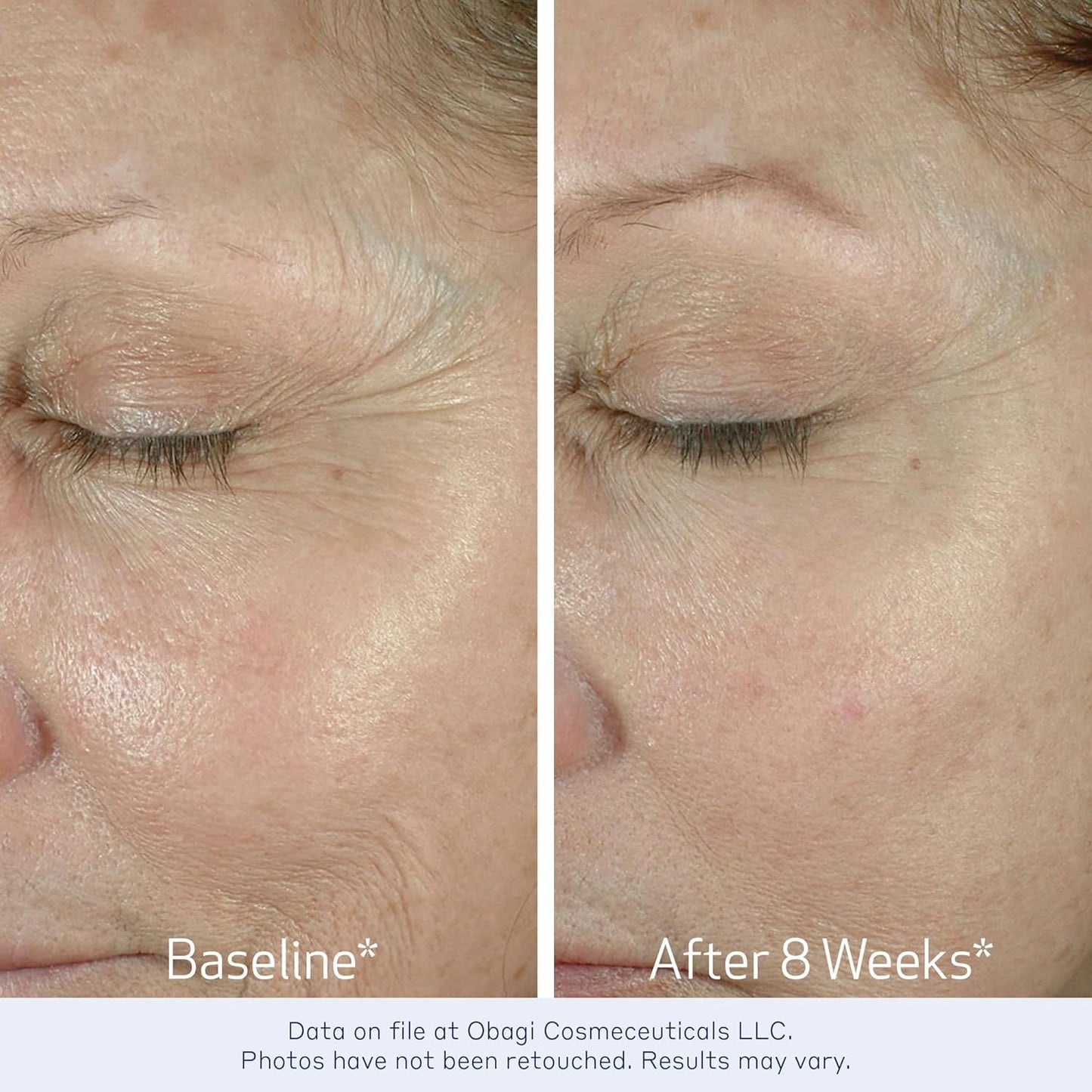 Obagi ELASTIderm Eye Cream – Lightweight, Smooth Formula Clinically Proven to Help Reduce the Appearance of Fine Lines & Wrinkles