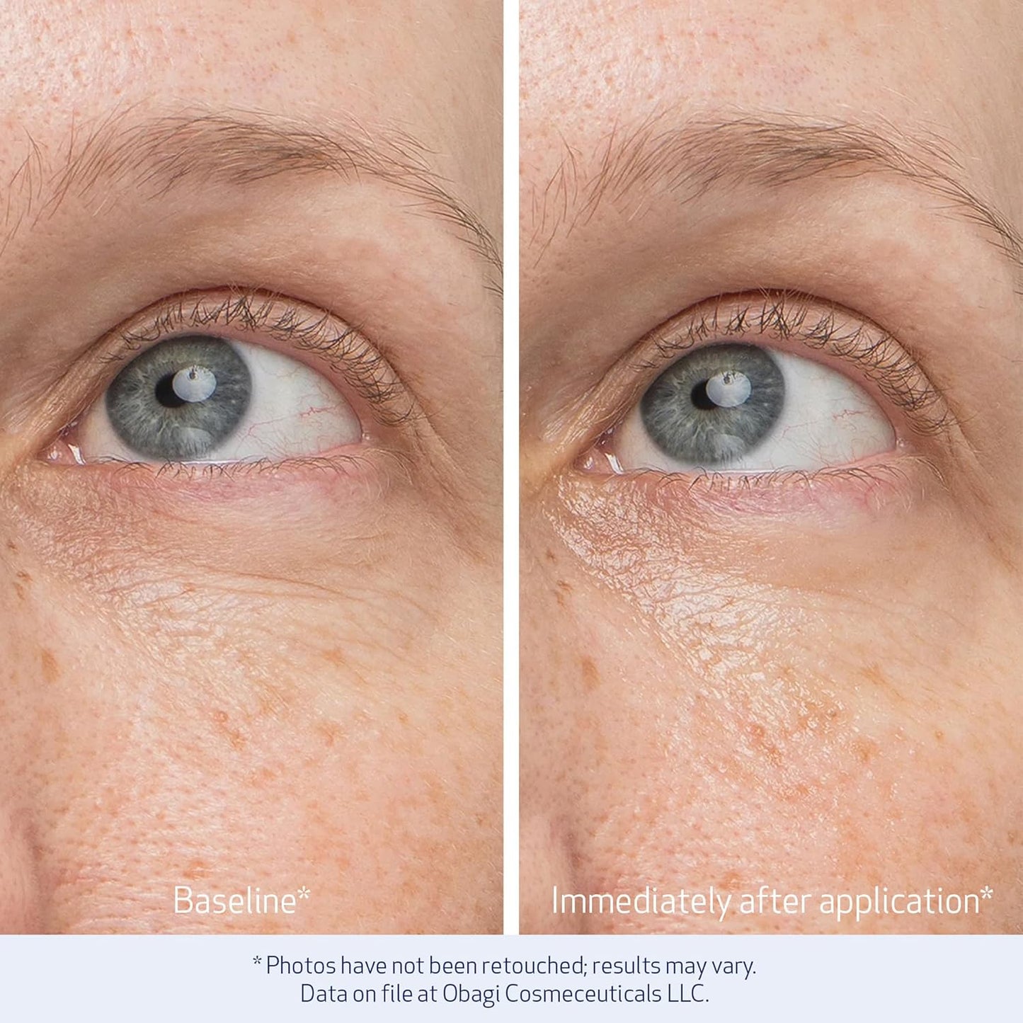 Obagi Daily Hydro-Drops Rejuvenating Eye Gel Cream – Reduces the Appearance of Dark Circles & Instantly Brightens, Smooths, & Depuffs Eyes – 0.5 oz