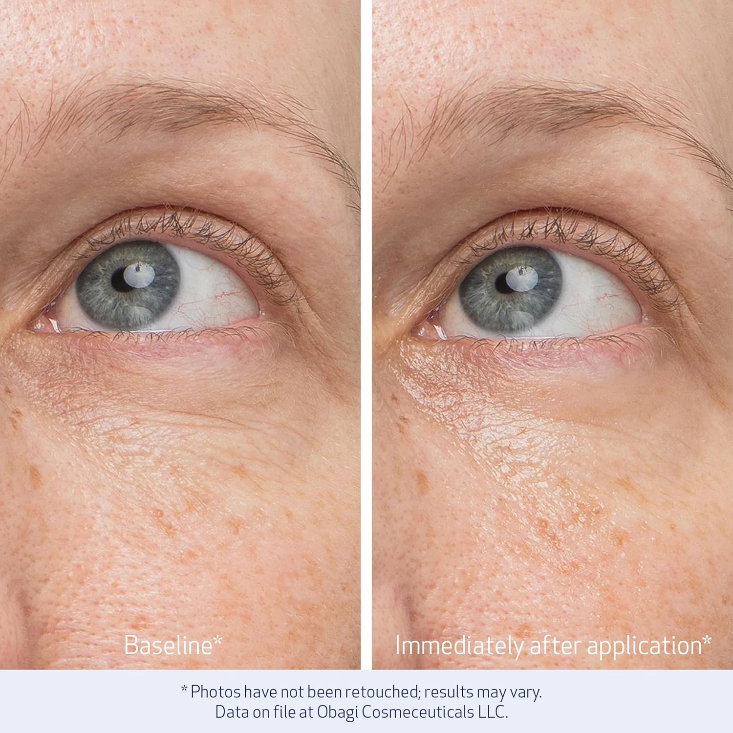 Obagi Daily Hydro-Drops Rejuvenating Eye Gel Cream – Reduces the Appearance of Dark Circles & Instantly Brightens, Smooths, & Depuffs Eyes – 0.5 oz