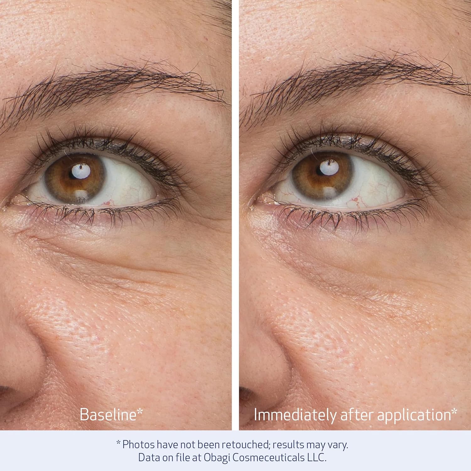 Obagi Daily Hydro-Drops Rejuvenating Eye Gel Cream – Reduces the Appearance of Dark Circles & Instantly Brightens, Smooths, & Depuffs Eyes – 0.5 oz